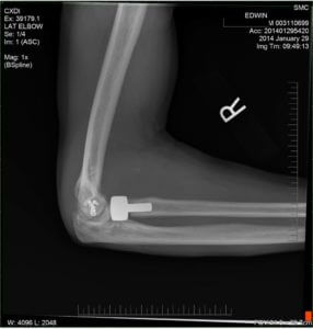 Man Injured in Unloading Accident