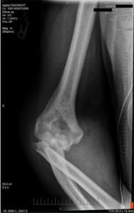 Man Injured in Unloading Accident
