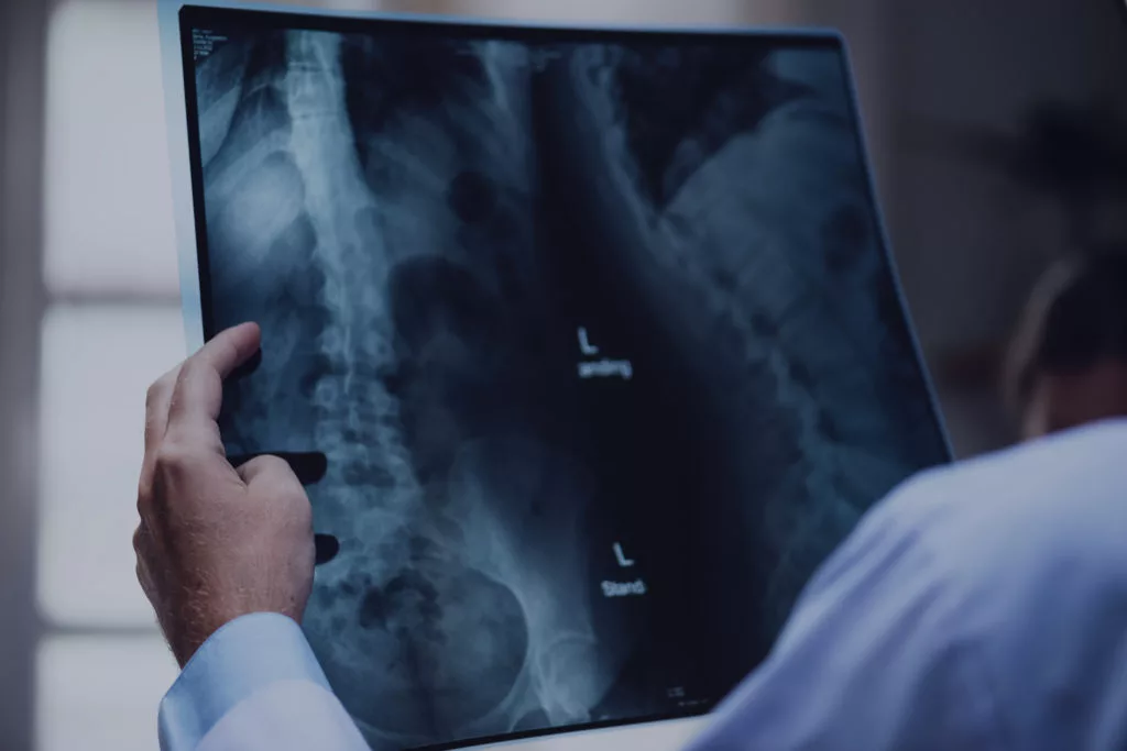 A photo of a medical professional reviewing an X-ray.